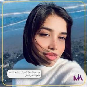 جراحی-بینی-89.1
