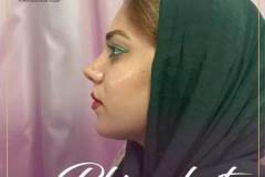 جراحی-بینی-46