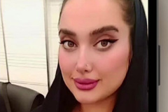 جراحی-بینی-63