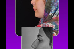 جراحی-بینی-69