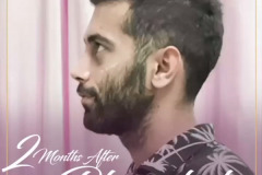 جراحی-بینی36