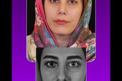 جراحی-بینی71
