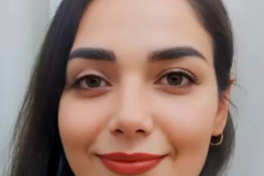 rhinoplasty99.1