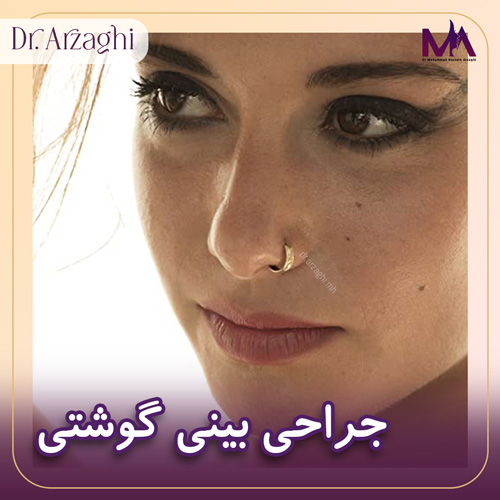 جراحی بینی گوشتی + دکتر محمد حسین ارزاقی