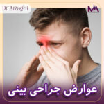 عوارض جراحی بینی