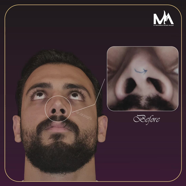 غکس جراح بینی ساری - دکتر محمد حسین ارزاقی
