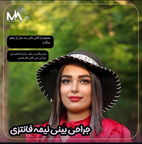 عکس نمونه کار جراحی بینی نیمه فانتزی