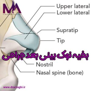 عکس بخیه نوک بینی بعد جراحی