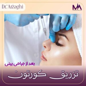 عکس تزریق کورتون بعد جراحی بینی