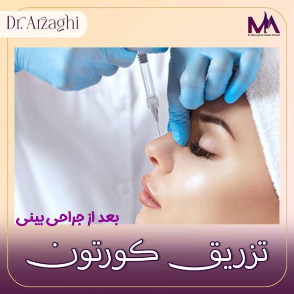 عکس تزریق کورتون بعد جراحی بینی