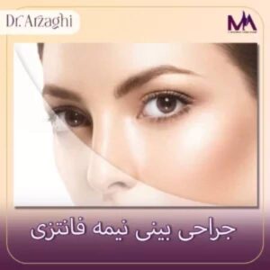 جراحی بینی نیمه فانتزی
