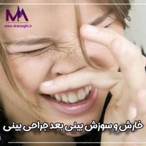 خارش و سوزش بینی بعد جراحی بینی