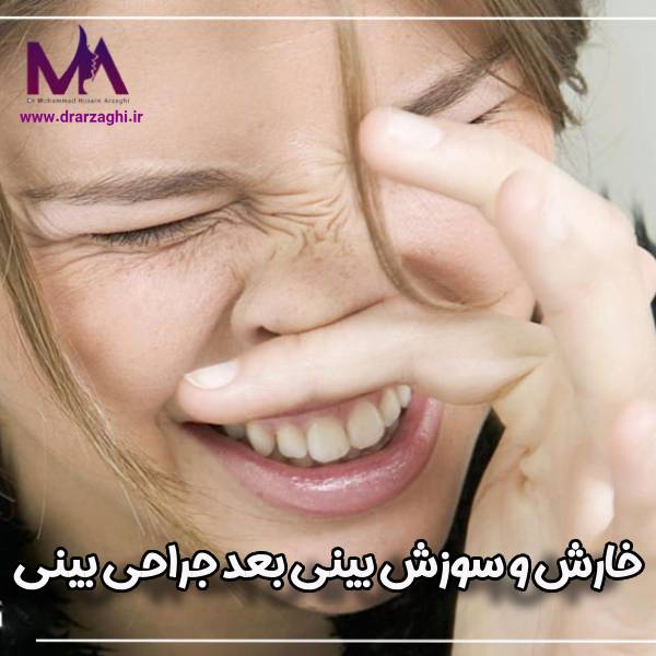 عکس خارش و سوزش بینی بعد جراحی بینی