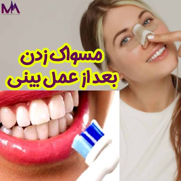مسواک زدن بعد از عمل بینی