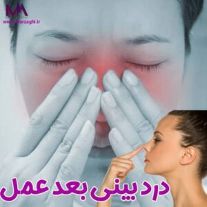 درد بینی بعد عمل - دکتر محمدحسین ارزاقی