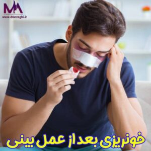 خونریزی بعد عمل بینی - دکتر محمدحسین ارزاقی